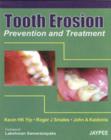 Image for Tooth Erosion Prevention and Treatment