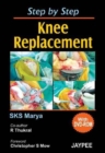 Image for Step by Step Knee Replacement