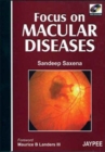Image for Focus on Macular Diseases