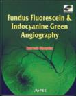 Image for Fundus Fluorescien and Indocyanine Green Angiography