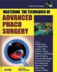 Image for Mastering the Techniques of Advanced Phaco Surgery