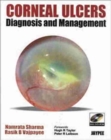 Image for Corneal Ulcers Diagnosis and Management