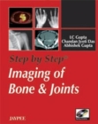 Image for Step by Step: Imaging of Bone and Joints
