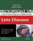 Image for Instant Clinical Diagnosis in Ophthalmology : Lens Diseases