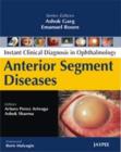 Image for Instant Clinical Diagnosis in Ophthalmology : Anterior Segment Lens Diseases
