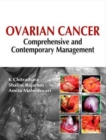 Image for OVARIAN CANCER COMPREHENSIVE CONTEMPORA