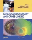 Image for Keratoconus Surgery and Cross-linking