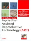 Image for Step by Step: Assisted Reproductive Technology (ART)