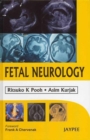 Image for Fetal Neurology