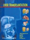 Image for Liver Transplantation