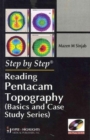 Image for Reading Pentacam Topography