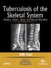 Image for Tuberculosis of the Skeletal System