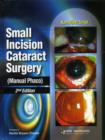 Image for Small Incision Cataract Surgery (Manual Phaco)