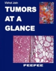 Image for Tumors at a Glance: Volume 1