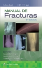 Image for Manual de fracturas