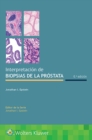 Image for Interpretacion de biopsias de la prostata