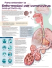 Image for Para entender la Enfermedad por coronavirus 2019 (COVID-19)