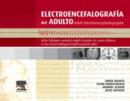 Image for Electroencefalografia del adulto: Atlas bilingue espanol-ingles basado en casos clinicos