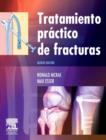 Image for Tratamiento practico de fracturas