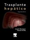 Image for Trasplante hepatico