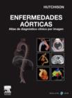 Image for Enfermedades aorticas: Atlas de diagnostico clinico por imagen