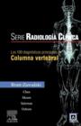 Image for Los 100 Diagnosticos Principales En Columna Vertebral