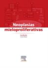 Image for Neoplasias Mieloproliferativas