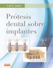 Image for Protesis dental sobre implantes