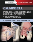 Image for Campbell. Principales procedimientos en cirugia ortopedica y traumatologia + ExpertConsult