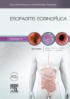 Image for Esofagitis eosinofilica: Clinicas Iberoamericanas de Gastroenterologia y Hepatologia