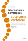 Image for Deformaciones morfologicas de la columna vertebral: Tratamiento fisioterapeutico en reeducacion postural global RPG