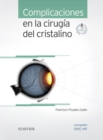 Image for Complicaciones en la cirugia del cristalino: Monografias SECOIR