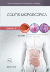 Image for Colitis microscopica: Clinicas Iberoamericanas de Gastroenterologia y Hepatologia vol.9