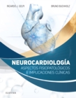 Image for Neurocardiología: Aspectos Fisiopatológicos E Implicaciones Clínicas