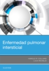 Image for Enfermedad pulmonar intersticial