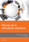 Image for Manejo de la retinopatia diabetica