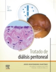 Image for Tratado De Diálisis Peritoneal