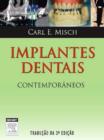 Image for Implantes Dentais Contemporaaneos