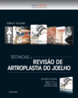 Image for Tecnicas de Revisao de Artroplastia do Joelho
