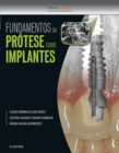Image for Fundamentos da Protese Sobre Implantes