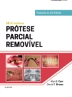 Image for McCracken Protese Parcial Removivel