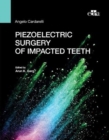 Image for Piezoelectric surgery of impacted teeth