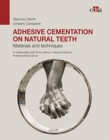 Image for Adhesive cementation on natural teeth - Materials and techniques