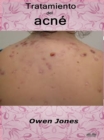 Image for Tratamiento Del Acne
