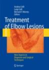 Image for Treatment of Elbow Lesions: New Aspects in Diagnosis and Surgical Techniques