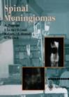 Image for Spinal Meningiomas