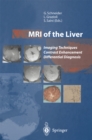 Image for MRI of the Liver: Imaging Techniques Contrast Enhancement Differential Diagnosis
