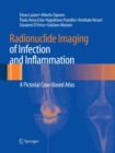 Image for Radionuclide Imaging of Infection and Inflammation