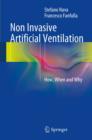 Image for Non invasive artificial ventilation: how, when and why