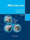 Image for MRI of the Liver : Imaging Techniques, Contrast Enhancement, Differential Diagnosis